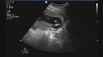 b超视频,胎儿成长轨迹全记录